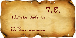 Tüske Beáta névjegykártya